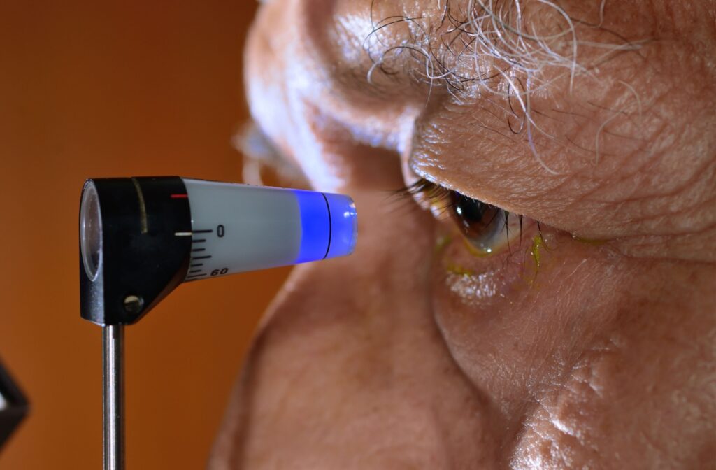 A close-up image of an older adult's eye during a tonometry test to check for glaucoma.